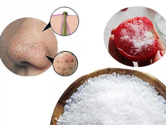 10 cách trị mụn đầu đen ở mũi tận gốc tại nhà an toàn và hiệu quả nhất