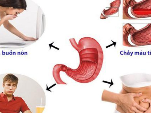 5 nguyên tắc ăn uống cho người bị viêm dạ dày, nên ”tuân thủ” để làm dịu cơn đau hiệu quả