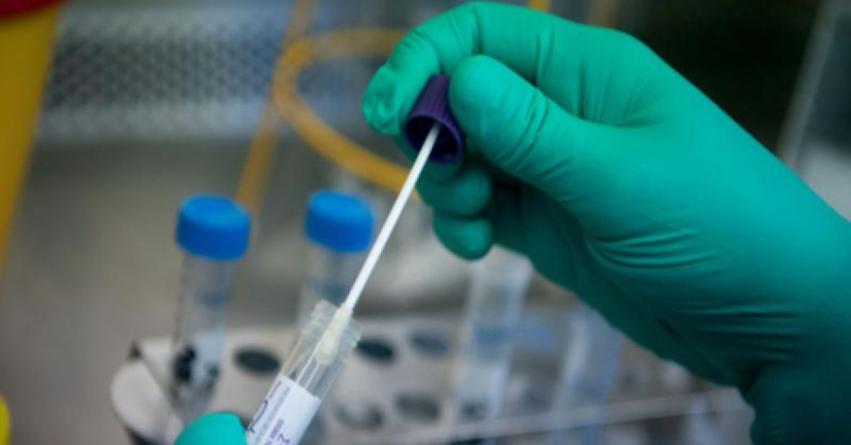 Không cho phép xét nghiệm Covid-19 theo yêu cầu