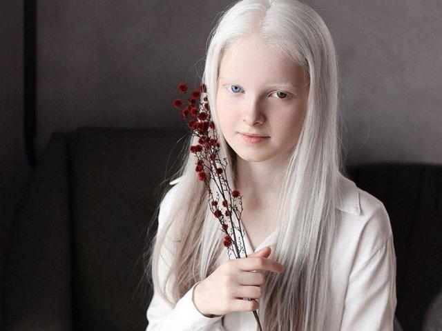 Cô gái Nga bị đột biến gen có đôi mắt hai màu, đẹp như tác phẩm nghệ thuật