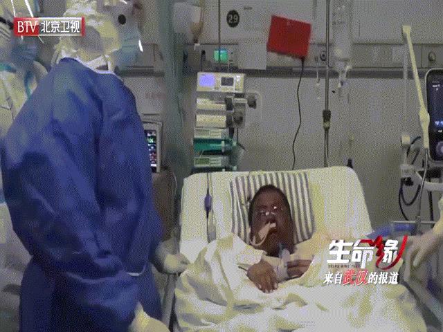 How does the Chinese doctor with Covid-19 skin turn black?