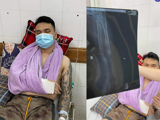 Khắc Việt bị chấn thương nghiêm trọng phải lên bàn mổ