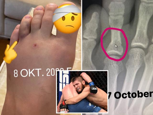 Khabib broke his leg and still had a knock-out attack, revealing the situation of 