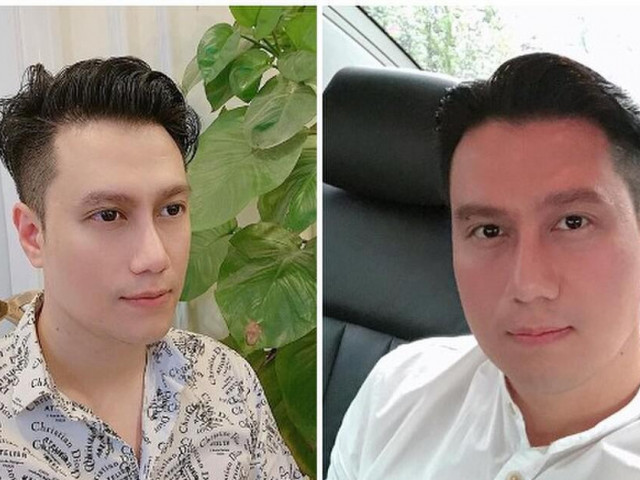 Những sao Việt phẫu thuật thẩm mỹ khiến khán giả không khỏi tiếc nuối