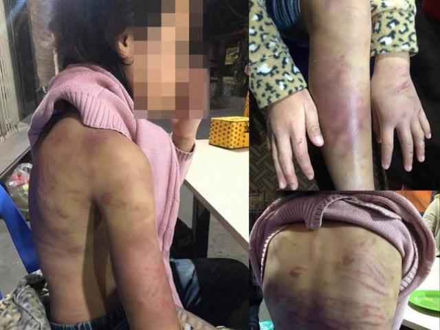 Bé gái 12 tuổi ở Hà Nội bị bạo hành, xâm hại: Cha dượng và mẹ ruột lĩnh án