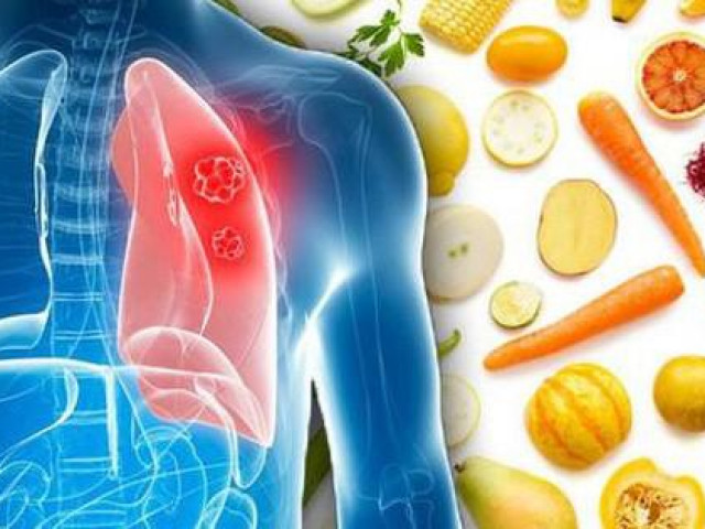 8 thực phẩm người bệnh ung thư phổi nên ăn thường xuyên
