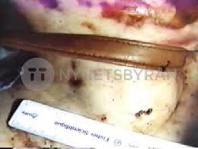 Người phụ nữ chết lõa thể trong sân trường: Manh mối từ hiện trường