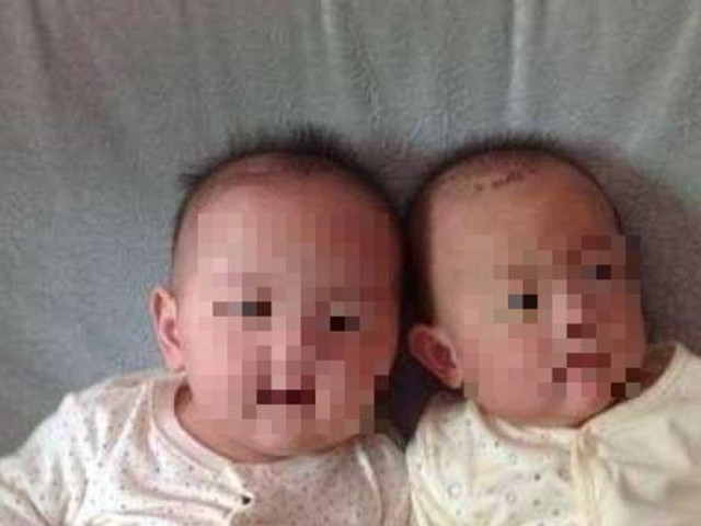 Hai bé trai song sinh trông quá khác nhau, kết quả xét nghiệm ADN vạch trần bí mật cay đắng