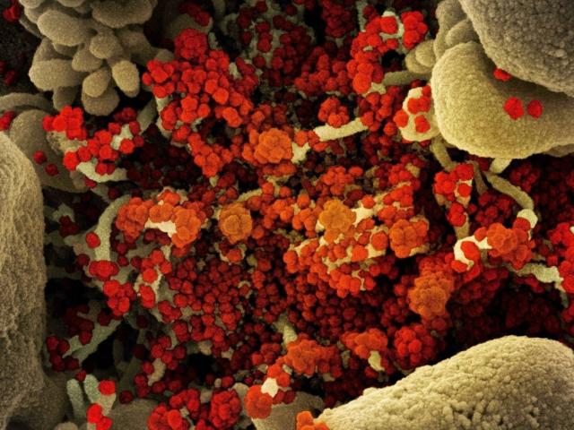 Chuyên gia: Biến thế Omicron có thể hình thành từ cơ thể bệnh nhân HIV